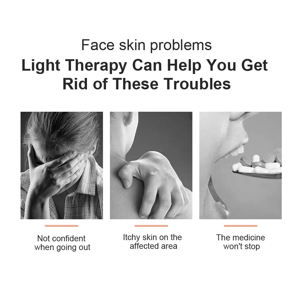 Lâmpada UVB para Vitiligo: Equ - Candle Making Supplies Uk avaliação e preço